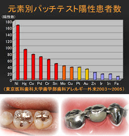 メタルフリー治療なら雑色歯科クリニックへ - 雑色歯科クリニック（雑色）